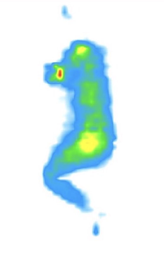 Pressure map for someone sleeping on the Saatva Classic on their side